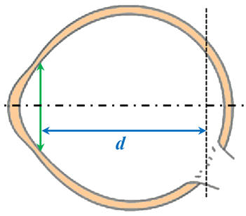 Oeil : schma