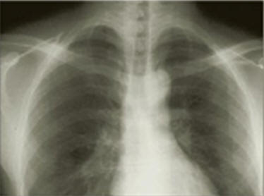 radiographie